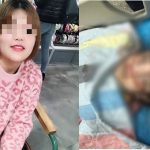 Cô gái 19 tuổi tử vong sau phẫu thuật nâng mũi bằng sụn tai