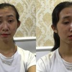 Bị bạn trai từ chối ngay lần gặp đầu cô gái quyết định ‘đập’ mặt làm lại