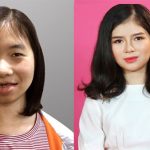 Cô gái bị chê là ‘ma cà rồng’ lột xác sau 5 lần phẫu thuật thẩm mỹ