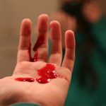 Cô gái bị thủng dạ dày, chỉ vì giảm cân theo cách nhiều người Việt đang làm