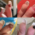 Cô gái trẻ suýt phải cắt cụt ngón tay vì điều ít để ý khi đi làm nail