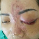 Cơ sở spa tiêm filler chui bị cơ quan chức năng bắt quả tang