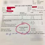 Đi chữa biến chứng sau nâng mí, cô gái Hà Nội ngã gục khi bác sĩ báo nhiễm HIV