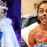 Hoa hậu 28 tuổi suy thận nặng vì liên tục uống ‘thần dược’