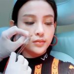 Huyền Baby chia sẻ video tiêm filler để giữ nhan sắc không tuổi