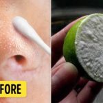 Mẹo đánh bật mụn đầu đen dễ dàng bằng cách chà nửa quả chanh lên mặt