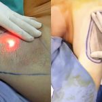 Nhật ký ‘đau thương’ của cô gái trẻ bỏ số tiền lớn triệt hôi nách