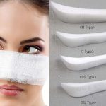 Nguy cơ tiềm ẩn sau những cách phẫu thuật nâng mũi đắt đỏ