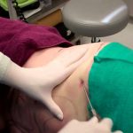 Quy trình hút mỡ bụng như nào, tại sao lại tử vong?