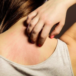 ban-soi-co-ngua-khong-nhung-dieu-can-biet-de-hieu-va-cham-soc-dung-cach