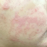 tat-tan-tat-ve-ban-soi-nhan-biet-nguyen-nhan-va-cach-phong-tranh-hieu-qua